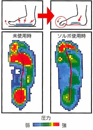 ソルボインソール